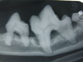 Las radiografías intraorales son fundamentales en la valoración de un individuo con periodontitis. Nótese la pérdida del hueso alveolar alrededor de los dientes afectados.
